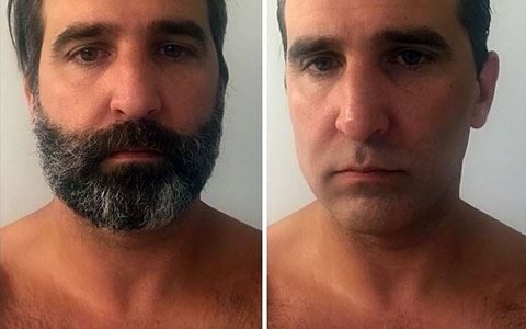 Крем Razorless Shaving: до и после