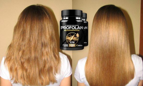Профолан (Profolan) для волос: отзывы, цена, где купить