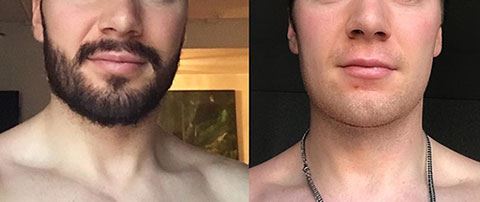 Крем Razorless Shaving: до и после