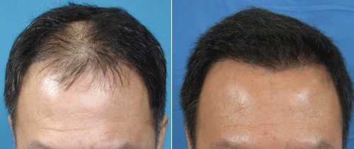 Спрей для волос Ultra Hair System: отзывы
